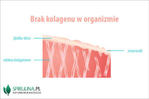 Brak kolagenu w organizmie