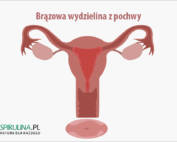 Brązowa wydzielina z pochwy