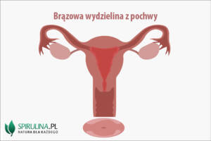 Brązowa wydzielina z pochwy