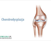 Chondrodysplazja