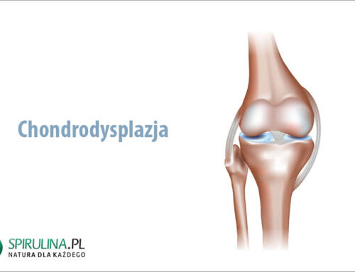 Chondrodysplazja