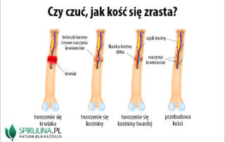 Czy czuć, jak kość się zrasta?