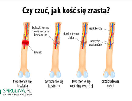 Czy czuć, jak kość się zrasta?