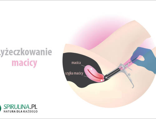 Łyżeczkowanie macicy