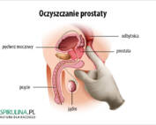Oczyszczanie prostaty