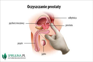 Oczyszczanie prostaty