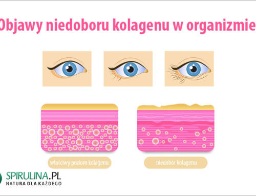 Objawy niedoboru kolagenu w organizmie