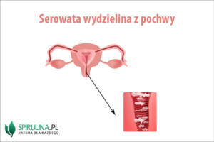 Serowata wydzielina z pochwy