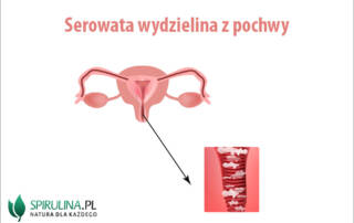 Serowata wydzielina z pochwy