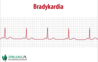 Bradykardia