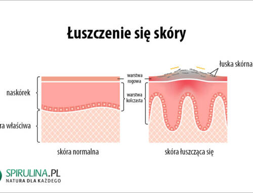 Łuszczenie się skóry