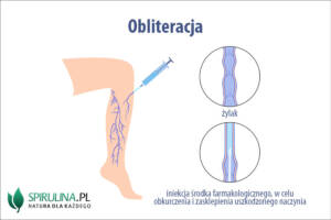 Obliteracja