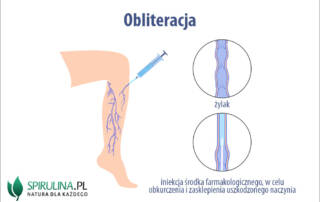 Obliteracja