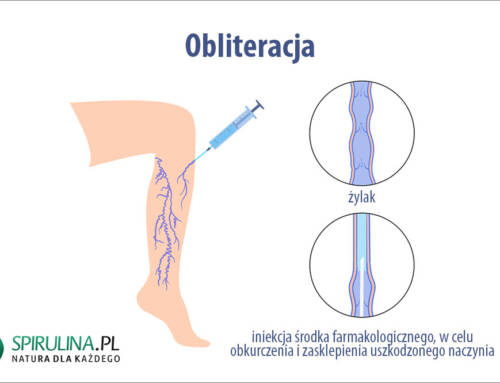 Obliteracja