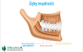 Zęby mądrości