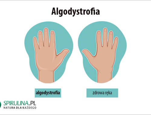 Algodystrofia