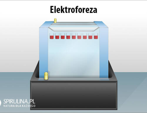 Elektroforeza