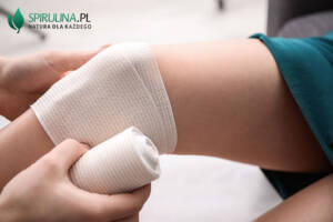 bandażowanie nóg po operacji żylaków