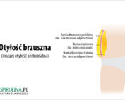 Otyłość brzuszna