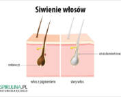 Siwienie włosów