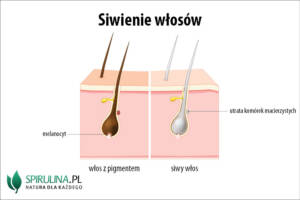 Siwienie włosów