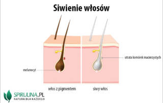 Siwienie włosów