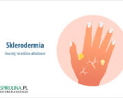 Sklerodermia