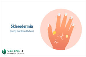 Sklerodermia