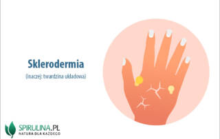 Sklerodermia