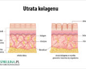 Utrata kolagenu
