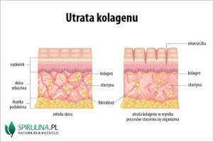 Utrata kolagenu