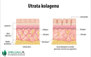 Utrata kolagenu