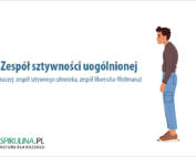 Zespół sztywności uogólnionej