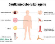 Skutki niedoboru kolagenu