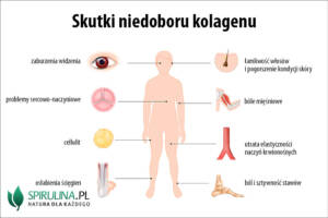 Skutki niedoboru kolagenu