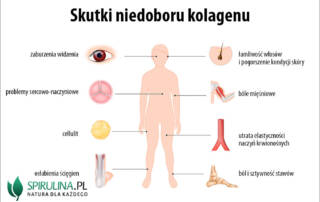 Skutki niedoboru kolagenu