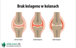 Brak kolagenu w kolanach