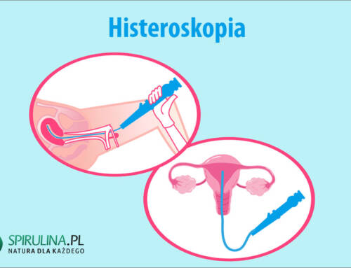 Histeroskopia