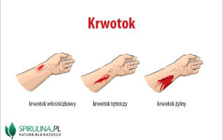 krwotok