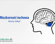 Niezborność ruchowa