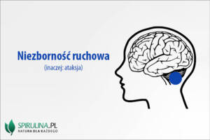 Niezborność ruchowa