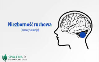 Niezborność ruchowa