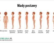 wady postawy