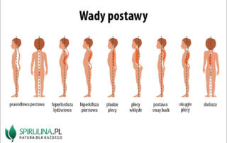 wady postawy