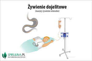 Żywienie dojelitowe