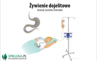 Żywienie dojelitowe