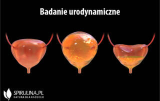 Badanie urodynamiczne