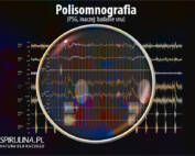 Polisomnografia