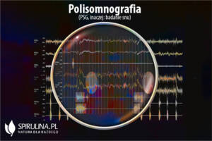 Polisomnografia