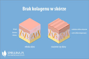 Brak kolagenu w skórze